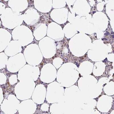 Immunohistochemistry ABCB10 Antibody - BSA Free