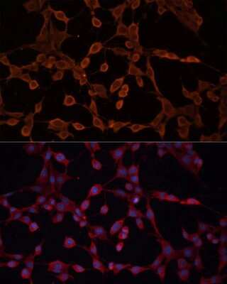 Immunocytochemistry/Immunofluorescence: ABCB11 Antibody [NBP2-92689] - Analysis of NIH-3T3 cells using ABCB11 . Blue: DAPI for nuclear staining.