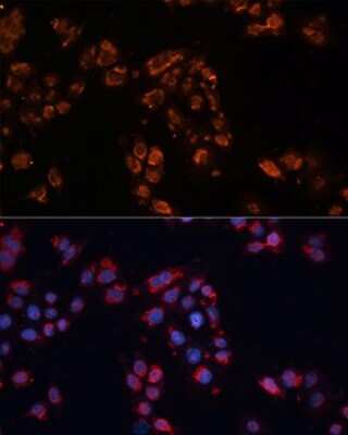 Immunocytochemistry/Immunofluorescence: ABCB11 Antibody [NBP2-92689] - Immunofluorescence analysis of HeLa cells using ABCB11 antibody (NBP2-92689) at dilution of 1:100. Blue: DAPI for nuclear staining.