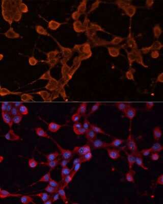 Immunocytochemistry/Immunofluorescence: ABCB11 Antibody [NBP3-03893] - Analysis of NIH/3T3 cells using ABCB11 antibody at dilution of 1:100. Blue: DAPI for nuclear staining.