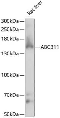 Western Blot: ABCB11 Antibody [NBP3-03893] - Analysis of extracts of rat liver, using ABCB11 antibody at 1:1000 dilution. Secondary antibody: HRP Goat Anti-Rabbit IgG (H+L) at 1:10000 dilution. Lysates/proteins: 25ug per lane. Blocking buffer: 3% nonfat dry milk in TBST. Detection: ECL Enhanced Kit