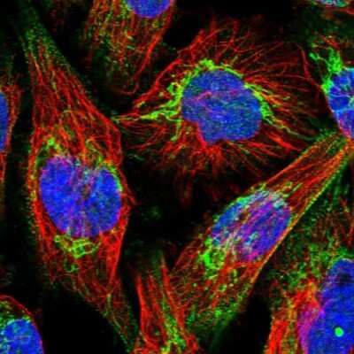 Immunocytochemistry/Immunofluorescence: ABCB8 Antibody [NBP1-91643] - Immunofluorescent staining of human cell line U-251 MG shows localization to nucleus & mitochondria.