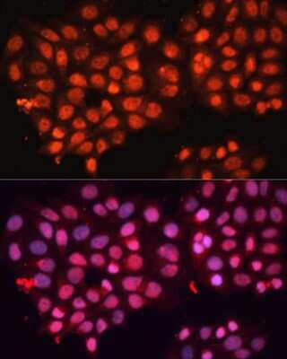 Immunocytochemistry/ Immunofluorescence ABCB8 Antibody - BSA Free