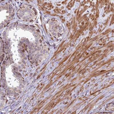 Immunohistochemistry-Paraffin: ABCB8 Antibody [NBP1-91643] - Staining of human prostate shows moderate cytoplasmic positivity in smooth muscle cells and in a subset of glandular cells.