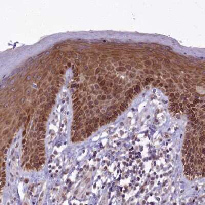 Immunohistochemistry-Paraffin: ABCB8 Antibody [NBP1-91643] - Staining of human skin shows strong cytoplasmic positivity in squamous epithelial cells.