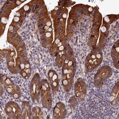 Immunohistochemistry-Paraffin: ABCB8 Antibody [NBP1-91643] - Staining of human duodenum shows strong cytoplasmic and membranous positivity in glandular cells.
