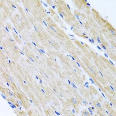 Immunohistochemistry-Paraffin ABCB8 Antibody - BSA Free