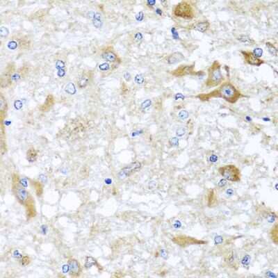 Immunohistochemistry-Paraffin: ABCB8 Antibody [NBP2-92883] - Rat brain using ABCB8 antibody at dilution of 1:100 (40x lens).