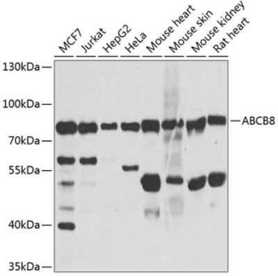 Western Blot ABCB8 Antibody - BSA Free
