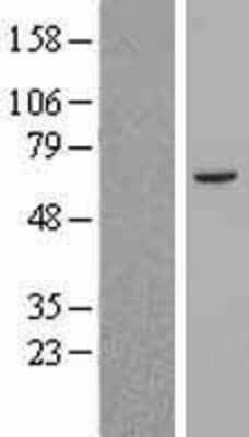 Western Blot: ABCB8 Overexpression Lysate (Adult Normal) [NBL1-07177] Left-Empty vector transfected control cell lysate (HEK293 cell lysate); Right -Over-expression Lysate for ABCB8.