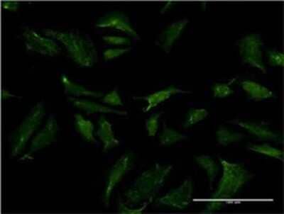 Immunocytochemistry/Immunofluorescence: ABCB9 Antibody (4F4) [H00023457-M01] - Analysis of monoclonal antibody to ABCB9 on HeLa cell . Antibody concentration 10 ug/ml.