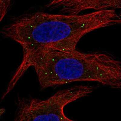 Immunocytochemistry/Immunofluorescence: ABCB9 Antibody [NBP2-55166] - Staining of human cell line U-2 OS shows localization to vesicles.