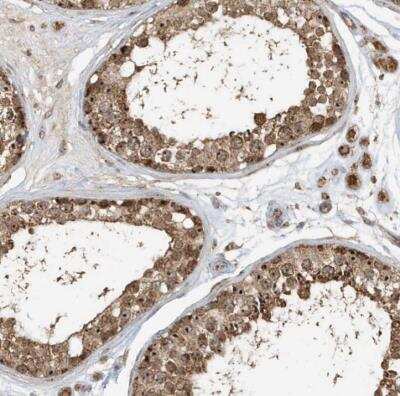 Immunohistochemistry-Paraffin: ABCB9 Antibody [NBP1-84783] - Staining of human testis shows strong cytoplasmic positivity.