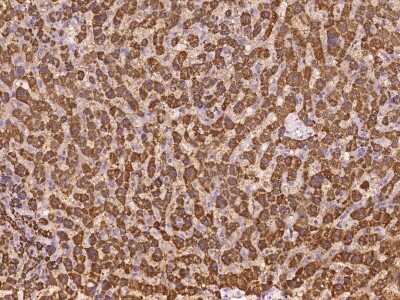 Immunohistochemistry-Paraffin: ABCB9 Antibody [NBP2-97176] - Immunochemical staining of human ABCB9 in human liver with rabbit polyclonal antibody at 1:100 dilution, formalin-fixed paraffin embedded sections.