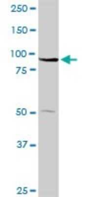 Western Blot: ABCB9 Antibody [H00023457-D01P] - Analysis of ABCB9 expression in mouse kidney.