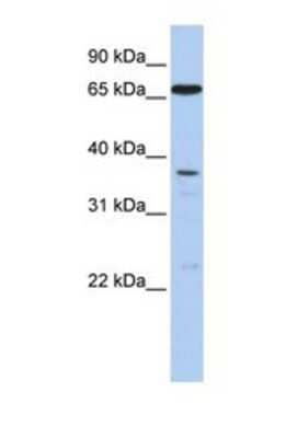 Western Blot: ABCB9 Antibody [NBP1-69513] - This Anti-ABCB9 antibody was used in Western Blot of Fetal Lung tissue lysate at a concentration of 1ug/ml.