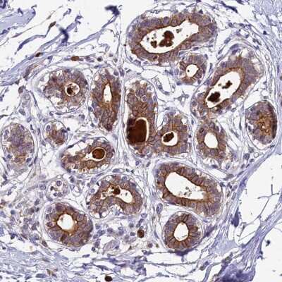 Immunohistochemistry-Paraffin ABCC10 Antibody - BSA Free