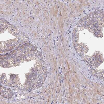 Immunohistochemistry ABCC10 Antibody - BSA Free