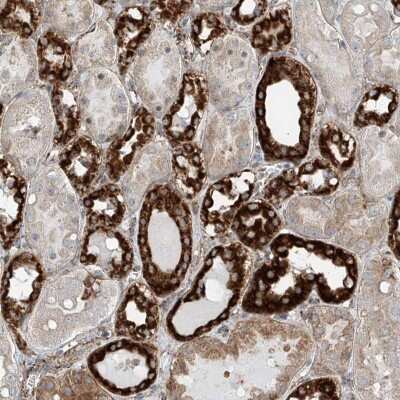 Immunohistochemistry-Paraffin: ABCC11 Antibody [NBP2-38193] - Staining of human kidney shows strong granular cytoplasmic positivity in cells in tubules.