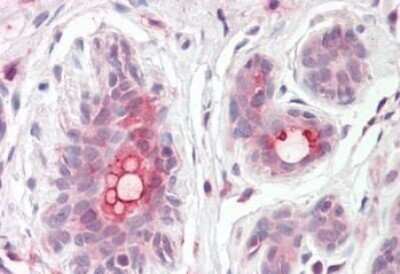 Immunohistochemistry-Paraffin: ABCC11 Antibody [NBP1-20944] - Staining of Human Breast tissue. antibody at 3.75 ug/mL. Steamed antigen retrieval with citrate buffer pH 6, AP-staining.