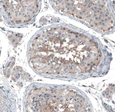 Immunohistochemistry-Paraffin: ABCC11 Antibody [NBP1-82623] - Staining of human testis shows weak cytoplasmic postivity in cells in seminiferous ducts.