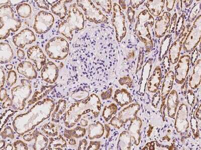 Immunohistochemistry-Paraffin: ABCC11 Antibody [NBP2-98606] - Immunochemical staining of human ABCC11 in human kidney with rabbit polyclonal antibody at 1:100 dilution, formalin-fixed paraffin embedded sections.