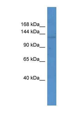 Western Blot: ABCC12 Antibody [NBP1-69063] - Mouse Spleen lysate, concentration 0.2-1 ug/ml.