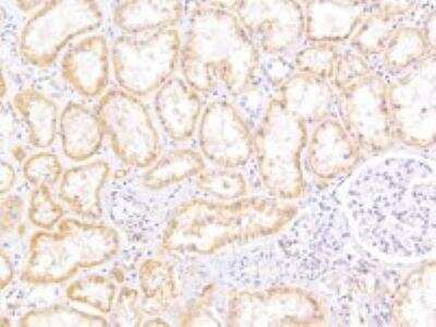 Immunohistochemistry-Paraffin: ABCC5 Antibody [NB100-94881] - staining of paraffin embedded Human Kidney. Antibody at 5 ug/mL. Heat induced antigen retrieval with citrate buffer pH 6, HRP-staining.