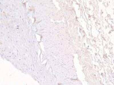 Immunohistochemistry-Paraffin ABCC5 Antibody