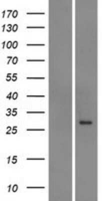 Western Blot: ABCC5 Overexpression Lysate (Adult Normal) [NBP2-08652] Left-Empty vector transfected control cell lysate (HEK293 cell lysate); Right -Over-expression Lysate for ABCC5.