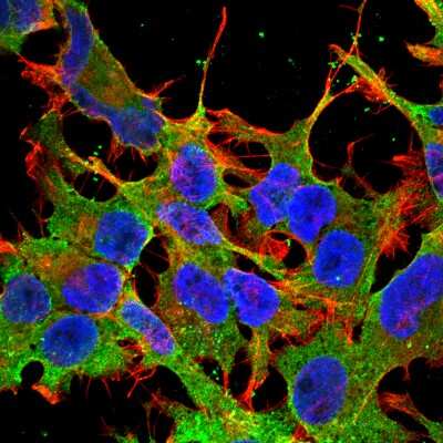 Immunocytochemistry/Immunofluorescence: ABCC9 Antibody (S319A-14) [NBP2-22403] - Tissue: Neuroblastoma cell line SK-N-BE. Species: Human. Fixation: 4% Formaldehyde for 15 min at RT. Primary Antibody: Mouse Anti-SUR2A Monoclonal Antibody at 1:100 for 60 min at RT. Secondary Antibody: Goat Anti-Mouse ATTO 488 at 1:100 for 60 min at RT. Counterstain: Phalloidin Texas Red F-Actin stain; DAPI (blue) nuclear stain at 1:1000, 1:5000 for 60min RT, 5min RT. Localization: Membrane. Magnification: 60X.