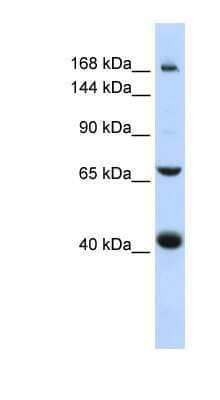 Western Blot: ABCC9 Antibody [NBP1-59350] - Titration: 0.2-1 ug/ml, Positive Control: 721_B cell lysate.