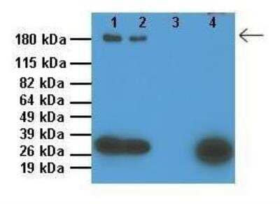 <b>Genetic Strategies Validation. </b>Western Blot: ABCC9 Antibody [NBP1-59350] - 1: 10ug SUR1 KO mouse ventricle lysate, 2: 10ug WT mouse ventricle lysate, 3: 0.1ug SUR1 overexpressing mouse ventricle lysate, 4: 10ug cannine ventricle lysate.