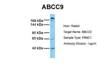 Western Blot: ABCC9 Antibody [NBP1-59350] - Sample Tissue: Human PANC1 Antibody Dilution: 1.0 ug/ml