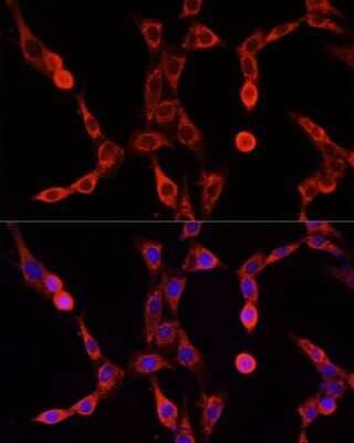 Immunocytochemistry/Immunofluorescence: ABCD1 Antibody [NBP2-92604] - Analysis of NIH/3T3 cells using ABCD1 at dilution of 1:100. Blue: DAPI for nuclear staining.