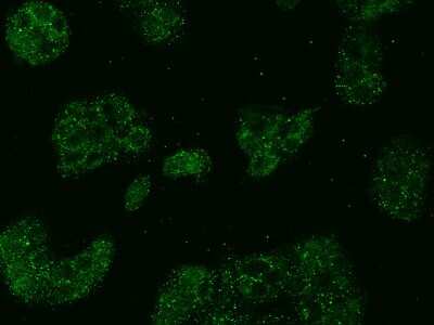 Immunocytochemistry/Immunofluorescence: ABCD1 Antibody [NBP2-99337] - Immunofluorescence staining of ABCD1 in MCF7 cells. Cells were fixed with 4% PFA, permeabilzed with 0.1% Triton X-100 in PBS, blocked with 10% serum, and incubated with rabbit anti-Human ABCD1 polyclonal antibody (dilution ratio 1:500) at 4C overnight. Then cells were stained with the Alexa Fluor(R)488-conjugated Goat Anti-rabbit IgG secondary antibody (green). Positive staining was localized to Cytoplasm.