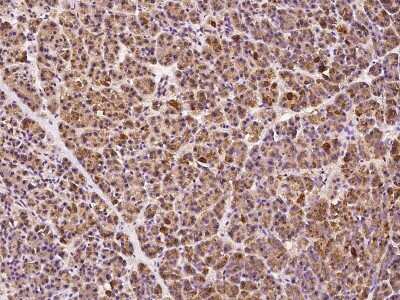 Immunohistochemistry-Paraffin: ABCD1 Antibody [NBP2-99337] - Immunochemical staining of human ABCD1 in human pancreas with rabbit polyclonal antibody at 1:300 dilution, formalin-fixed paraffin embedded sections.