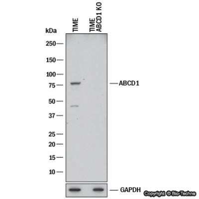 <b>Genetic Strategies Validation. </b>Knockout Validated: ABCD1 Antibody (OTI2C12) - Azide and BSA Free [NBP2-70150] - Western blot shows lysates of TIME human endothelial parental cell line and ABCD1 knockout (KO) TIME cell line. PVDF membrane was probed with 1:2000 of Mouse Anti-Human ABCD1 Monoclonal Antibody (Catalog # NBP2-46476) followed by HRP-conjugated Anti-Mouse IgG Secondary Antibody (Catalog #HAF018). Specific band was detected for ABCD1 at approximately 75 kDa (as indicated) in the parental TIME cell line, but is not detectable in the knockout TIME cell line. This experiment was conducted under reducing conditions.