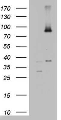 Western Blot: ABCD1 Antibody (OTI2C12) - Azide and BSA Free [NBP2-70150] - Analysis of HEK293T cells were transfected with the pCMV6-ENTRY control (Left lane) or pCMV6-ENTRY ABCD1.