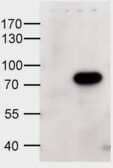 Western Blot: ABCD1 Antibody [NB100-96913] - HEK293 overexpressing human ABCD1 and probed with NB100-96913 at 1ug/ml (mock transfection in first lane).