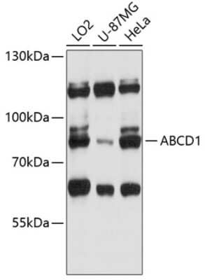 Western Blot: ABCD1 Antibody [NBP2-92604] - Analysis of extracts of various cell lines, using ABCD1 at 1:3000 dilution.Secondary antibody: HRP Goat Anti-Rabbit IgG (H+L) at 1:10000 dilution.Lysates/proteins: 25ug per lane.Blocking buffer: 3% nonfat dry milk in TBST.Detection: ECL Basic Kit .Exposure time: 30s.