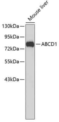 Western Blot: ABCD1 Antibody [NBP3-03973] - Analysis of extracts of mouse liver, using ABCD1 antibody . Secondary antibody: HRP Goat Anti-Rabbit IgG (H+L) at 1:10000 dilution. Lysates/proteins: 25ug per lane. Blocking buffer: 3% nonfat dry milk in TBST.
