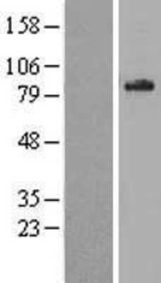 Western Blot: ABCD1 Overexpression Lysate (Adult Normal) [NBL1-07179] Left-Empty vector transfected control cell lysate (HEK293 cell lysate); Right -Over-expression Lysate for ABCD1.