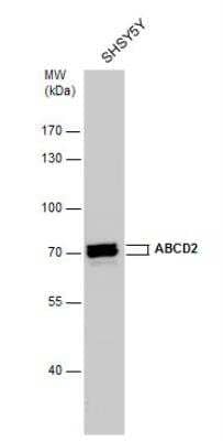 Western Blot: ABCD2 Antibody [NBP1-33435] - Whole cell extracts (30 ug) was separated by 7.5% SDS-PAGE, and the membrane was blotted with ABCD2 antibody  diluted by 1:500.