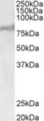 Western Blot: ABCD2 Antibody [NBP2-26123] - NBP2-26123 (1ug/ml) staining of Human Liver lysate (35ug protein in RIPA buffer). Primary incubation was 1 hour. Detected by chemiluminescence.