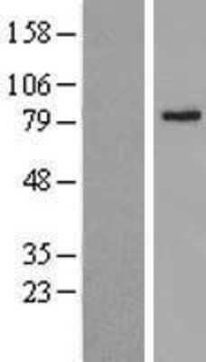 Western Blot: ABCD2 Overexpression Lysate (Adult Normal) [NBL1-07180] Left-Empty vector transfected control cell lysate (HEK293 cell lysate); Right -Over-expression Lysate for ABCD2.