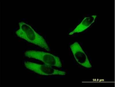Immunocytochemistry/Immunofluorescence: ABCF1 Antibody [H00000023-B01P] - Analysis of purified antibody to ABCF1 on HeLa cell. (antibody concentration 10 ug/ml)