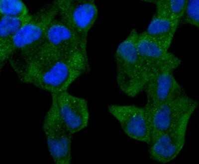 Immunocytochemistry/Immunofluorescence: ABCF1 Antibody (SN07-12) [NBP2-67698] - Staining ABCF1 in Hela cells (green). The nuclear counter stain is DAPI (blue). Cells were fixed in paraformaldehyde, permeabilised with 0.25% Triton X100/PBS.