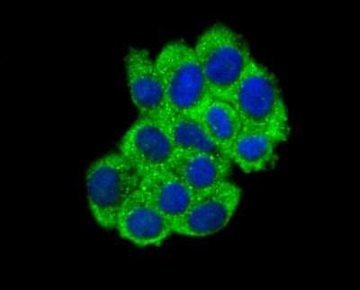 Immunocytochemistry/Immunofluorescence: ABCF1 Antibody (SN07-12) [NBP2-67698] - Staining ABCF1 in HepG2 cells (green). The nuclear counter stain is DAPI (blue). Cells were fixed in paraformaldehyde, permeabilised with 0.25% Triton X100/PBS.
