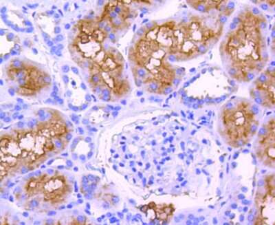 Immunohistochemistry-Paraffin: ABCF1 Antibody (SN07-12) [NBP2-67698] - Analysis of paraffin-embedded human kidney tissue using anti-ABCF1 antibody. Counter stained with hematoxylin.